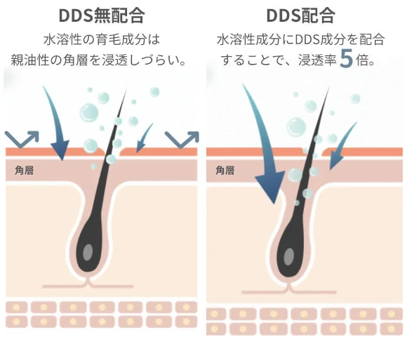 ラシックユー育毛剤高浸透技術DDS