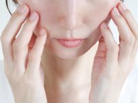 赤ら顔（酒さ）に悩む女性