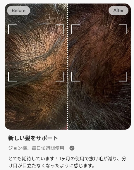 カレントボディ頭皮ケアデバイスビフォーアフター